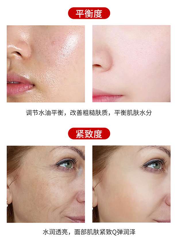 POMANLIN Medical treatment to fade wrinkles French lines eye lines