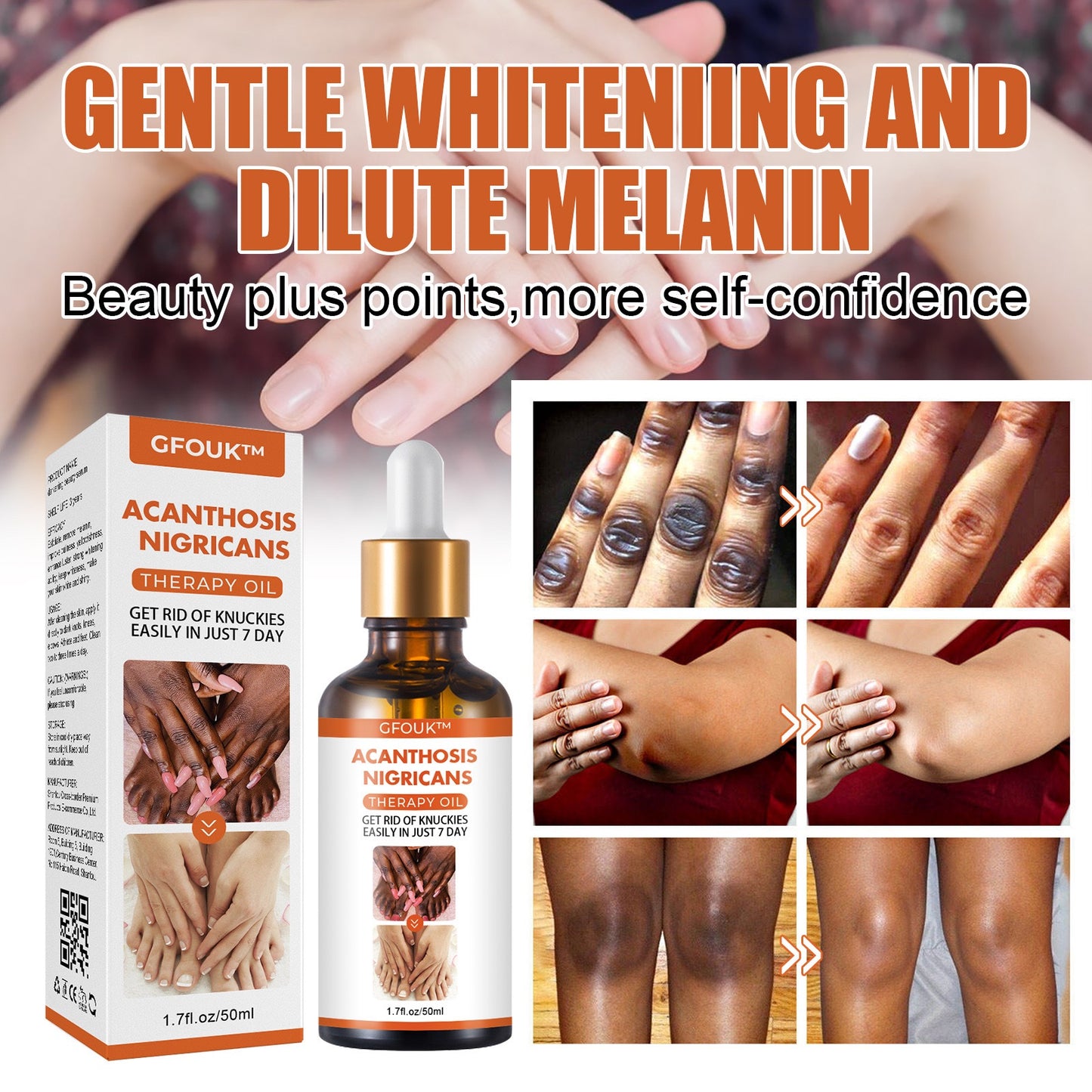 DARK KNUCKLE WHITENING SERUM
SUPERB SKIN RESTORATION THERAPY OIL