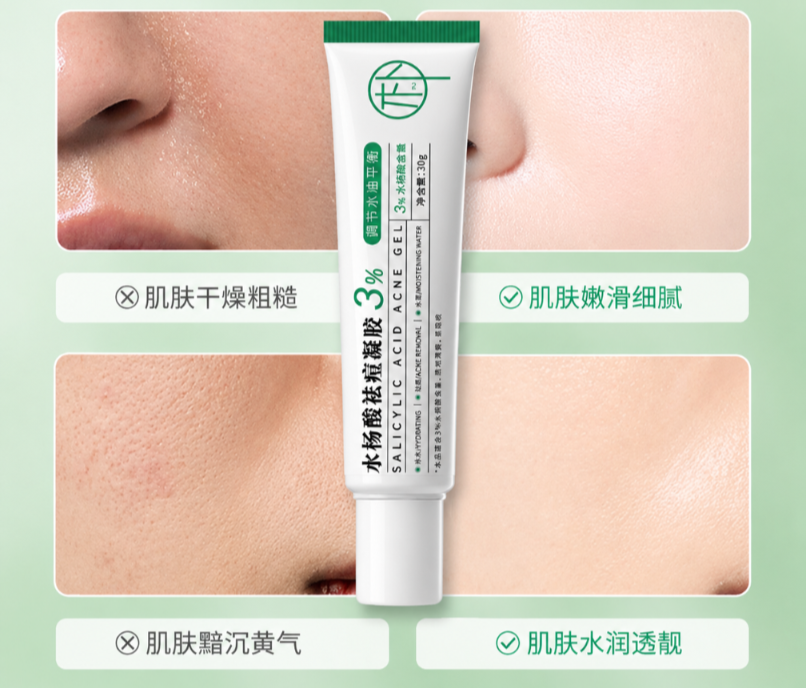 Salicylic Acid Face Cream Pimples and Dry skin treatment 30g