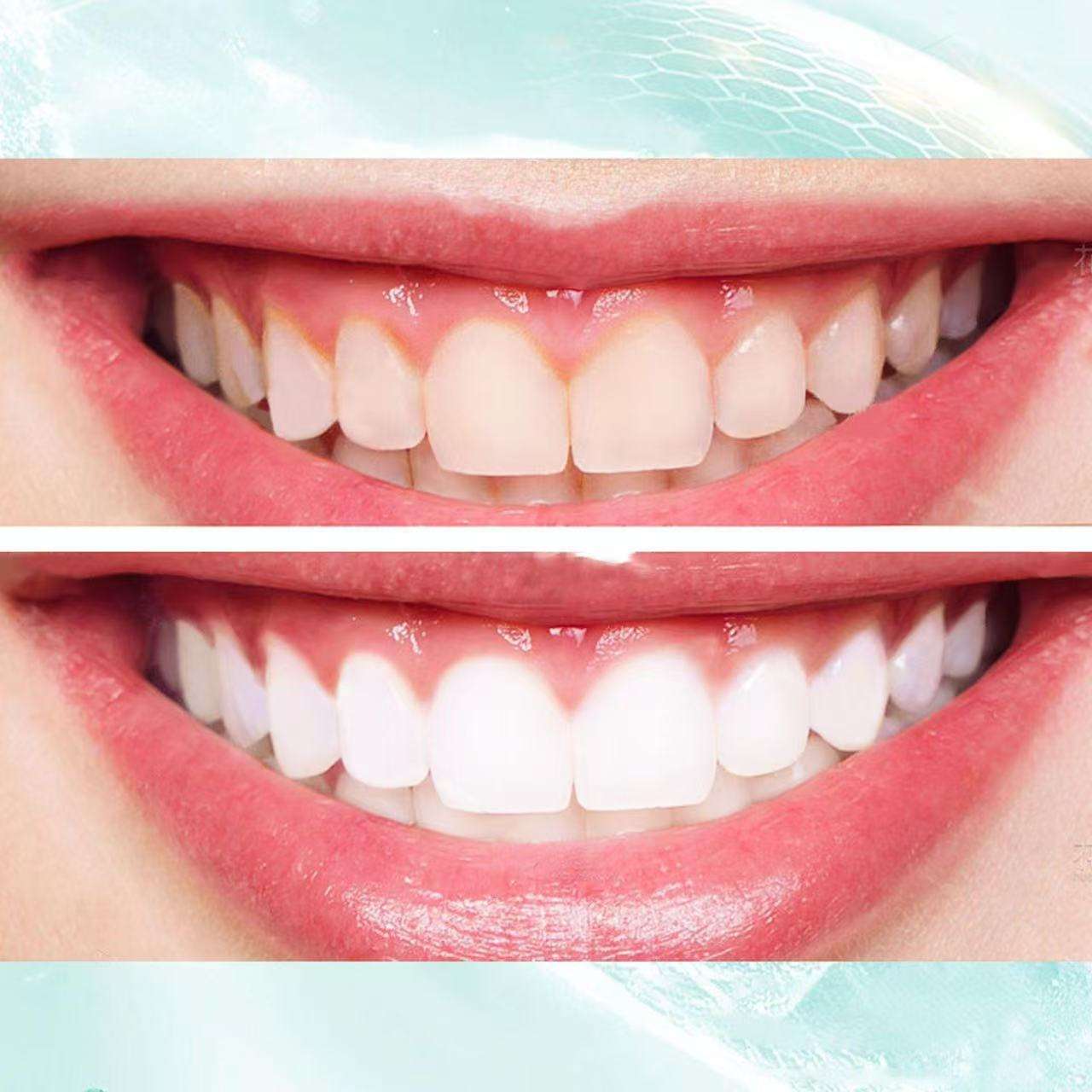 Baking soda Vegan toothpaste Teeth whitening