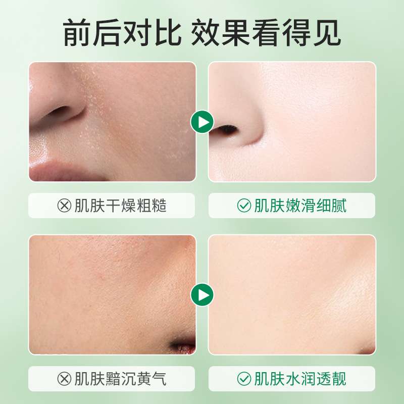 Salicylic Acid Face Cream Pimples and Dry skin treatment 20g