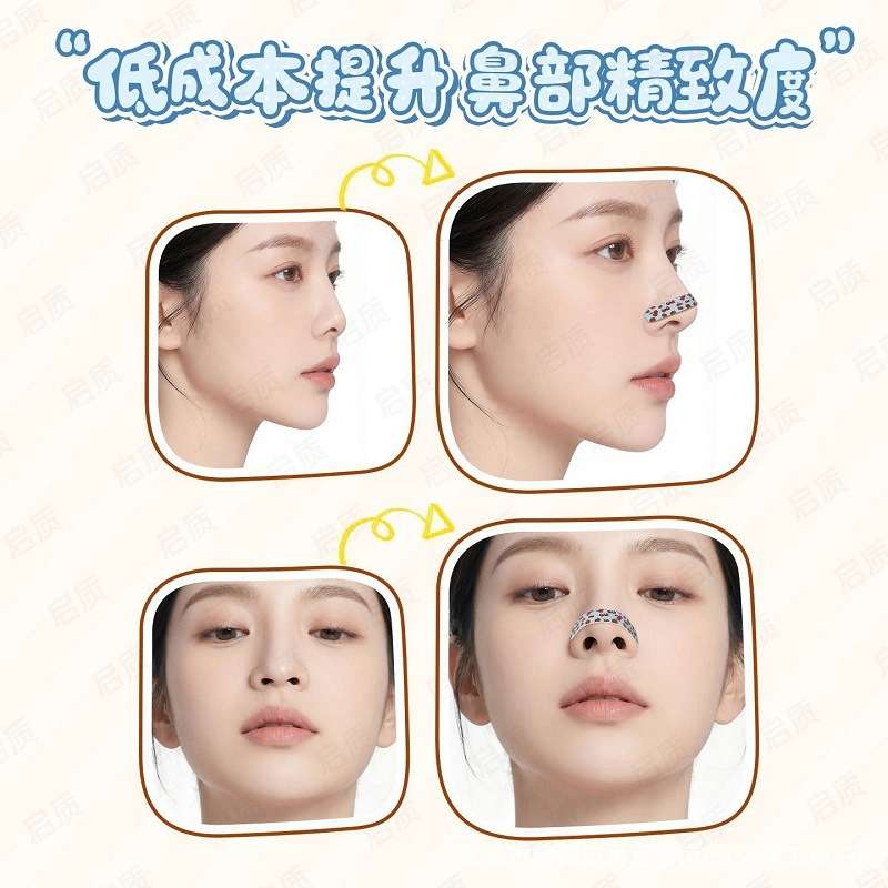Botox Nose Wing Stickers for Shaping and Lifting the Nose,