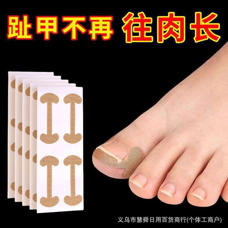 Deformation Ingrown Foot Corrector 4pcs