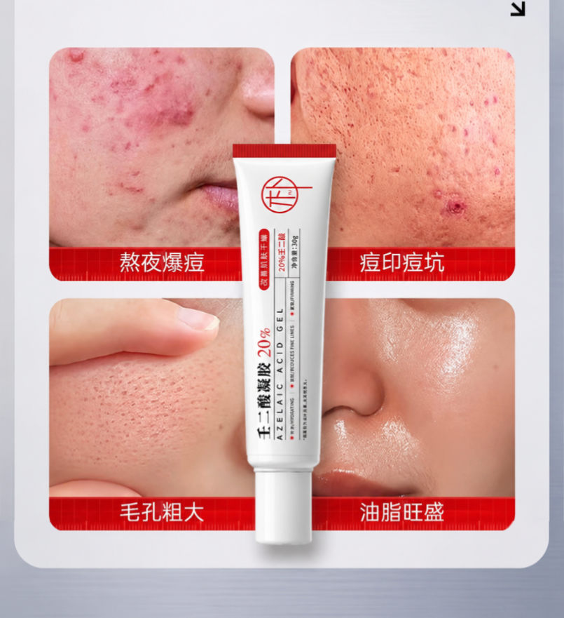 20 % Azelaic acid gel 30g; Skin oil control and Shrink pores