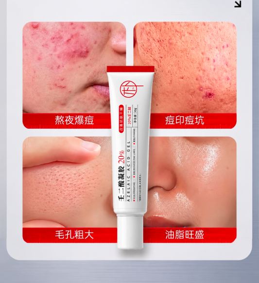 20 % Azelaic acid gel 30g; Skin oil control and Shrink pores