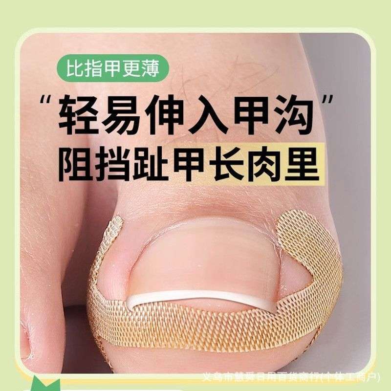 Deformation Ingrown Foot Corrector 4pcs