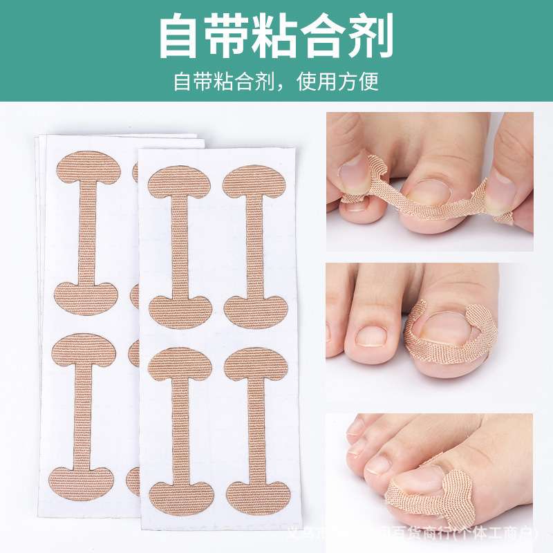 Deformation Ingrown Foot Corrector 4pcs